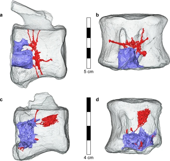 Трехмерная реконструкция опухолей и сосудов в двух позвонках / © Rothschild, Tanke et al., Scientific Reports, 2020