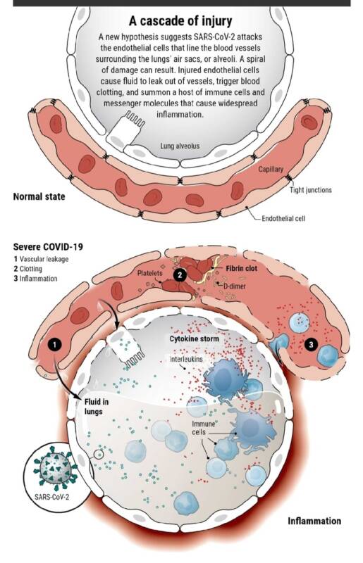  Процесс образования тромбов при заражении Covid-19 / © TEUWEN  ET AL. –  NAT.  REV. IMMUNOL. (2020), адаптирован V. ALTOUNIAN/ SCIENCE 