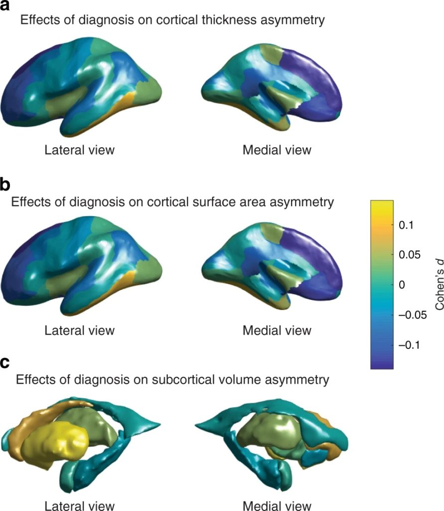 МРТ показало, как изменена толщина различных областей коры у людей с аутизмом. a — региональная толщина кортикального слоя, b — площадь поверхности коры, c — подкорковые объемы /© Nature Communications, 2019 