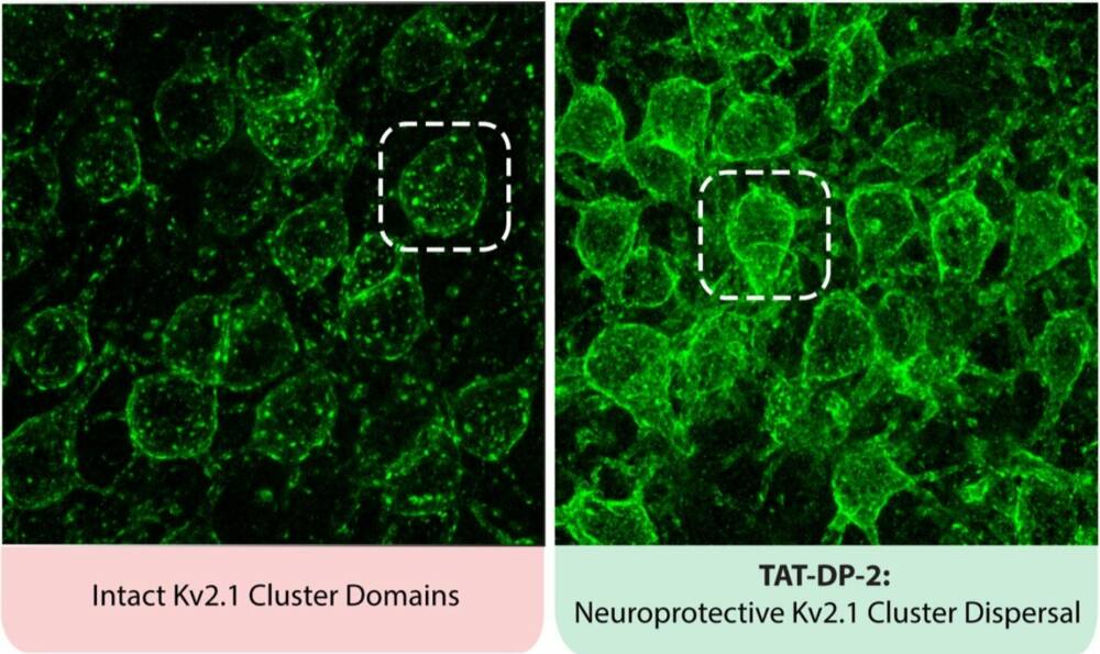  ТАТ-DP-2 расщепляет кластеры калиевых каналов на поверхности нейронов. / © Anthony Schulien 
