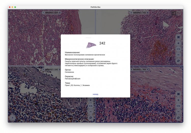 Демонстрация функционала программы PathScribe. Скриншот программы предоставлен разработчиком А.В. Хвостиковым