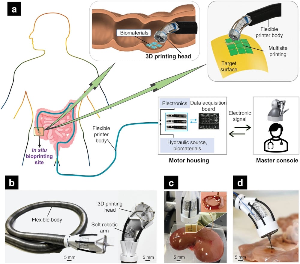 3D-печать внутри тела становится возможной благодаря новому типу гибкой роботизированной руки