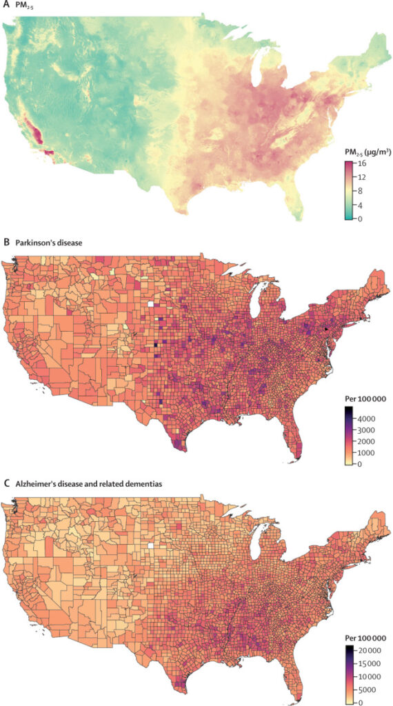  Показатели содержания твердых мелких частиц (PM 2,5) по всем Соединенным Штатам Америки, а также распределение страдающих болезнью Паркинсона, болезнью Альцгеймера и связанными с ней деменциями / © The Lancet