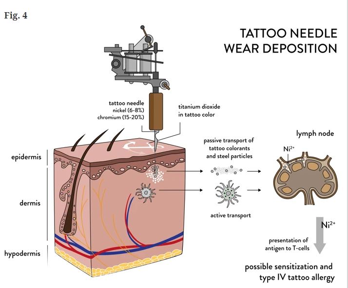 Иглы для татуировок оставляют под кожей не только чернила, заявили ученые