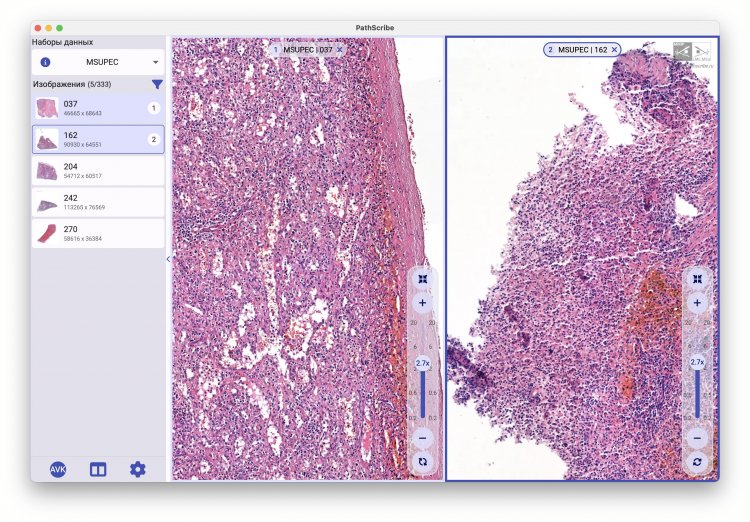 MSUPEC (Moscow State University Pathology Education Collection) — коллекция оцифрованных учебных микропрепаратов к курсу патологической анатомии факультета фундаментальной медицины МГУ им. М.В. Ломоносова. Все изображения учебных микропрепаратов аннотированы (номер, название, эталонное микроскопическое описание, теги). Скриншот программы предоставлен разработчиком А.В. Хвостиковым