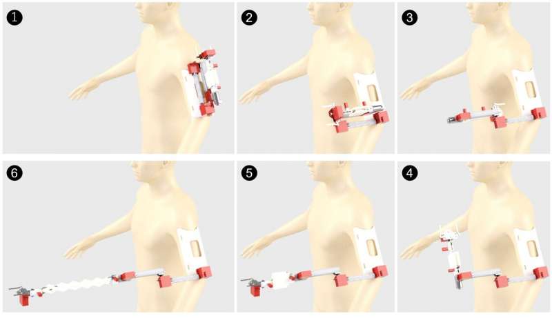 AugLimb может раскладываться в длину и складываться обратно / © Ding et al.