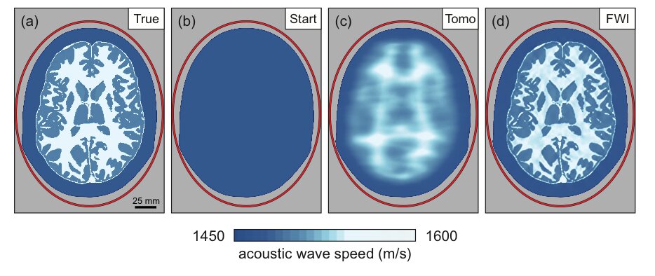 а) 2D-модель скорости акустической волны в мозге (без учета костной ткани черепа). Красный эллипс показывает положения преобразователя. б) Однородная модель, используемая для начала инверсии. в) Результат ультразвуковой компьютерной томографии. Полученная модель является точной, но имеет плохое пространственное разрешение. г) Результат ультразвуковой инверсии полной формы волны. Полученная модель теперь точна и достаточно информативна /© Imperial College London 