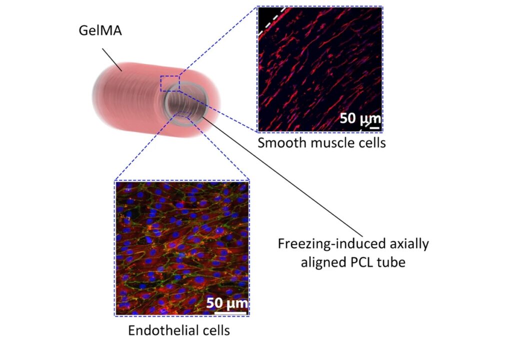 Схема готовой структуры и микрофотографии двух слоев: внешнего (из мышечных клеток) и внутреннего (из клеток эндотелия) / ©Alkazemi et al., 2023