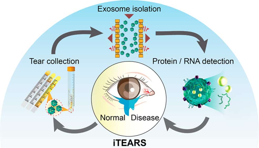 Краткое описание схемы работы системы iTEARS / © Liang Hu et al, ACS Nano, 2022