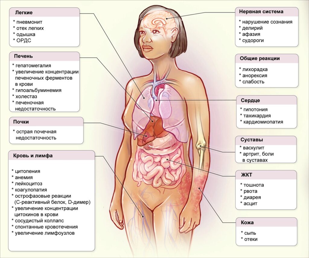 Клинические проявления цитокинового шторма / Источник: DOI: 10.1056/NEJMra2026131