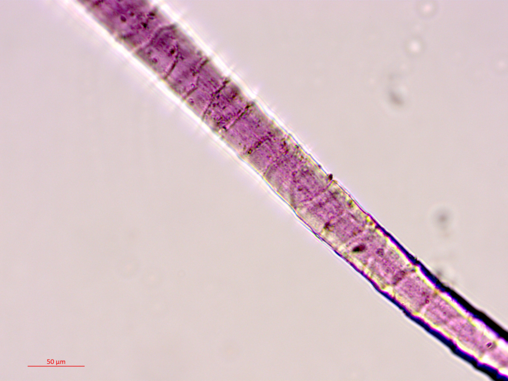 Одно из волокон под поляризационным микроскопом / © Наама Сукеник 
