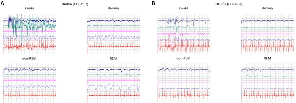 Полисомнограммы стадий сна: (А) собака с долихоцефалией (низкий цефалический индекс), (B) собака с брахицефалией (высокий цефалический индекс) / © Ivaylo Borislavov Iotchev et al.