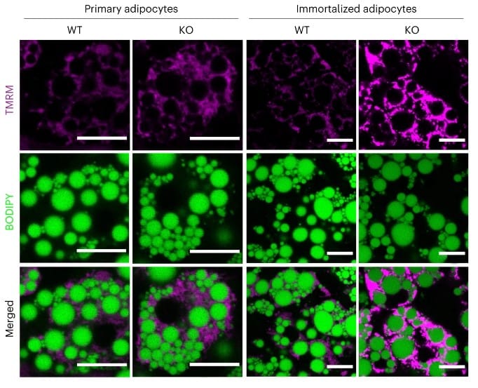 Адипоциты, окрашенные флуоресцентными красителями (WT — дикого типа, KO — с генным нокаутом) / © W. Xia et al., 2024
