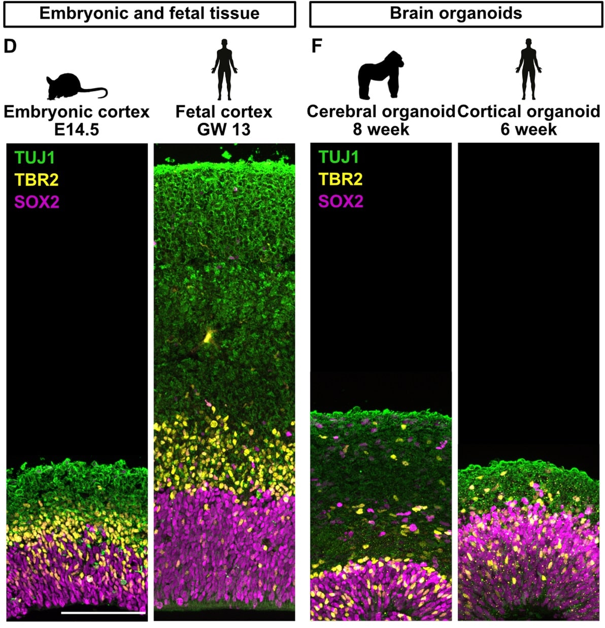 Иммунофлуоресценция тканей мышиного и человеческого неокортекса (слева), а также органоидов мозга гориллы и человека (справа) / © Paula Cubillos et al, EMBO Journal (2024)