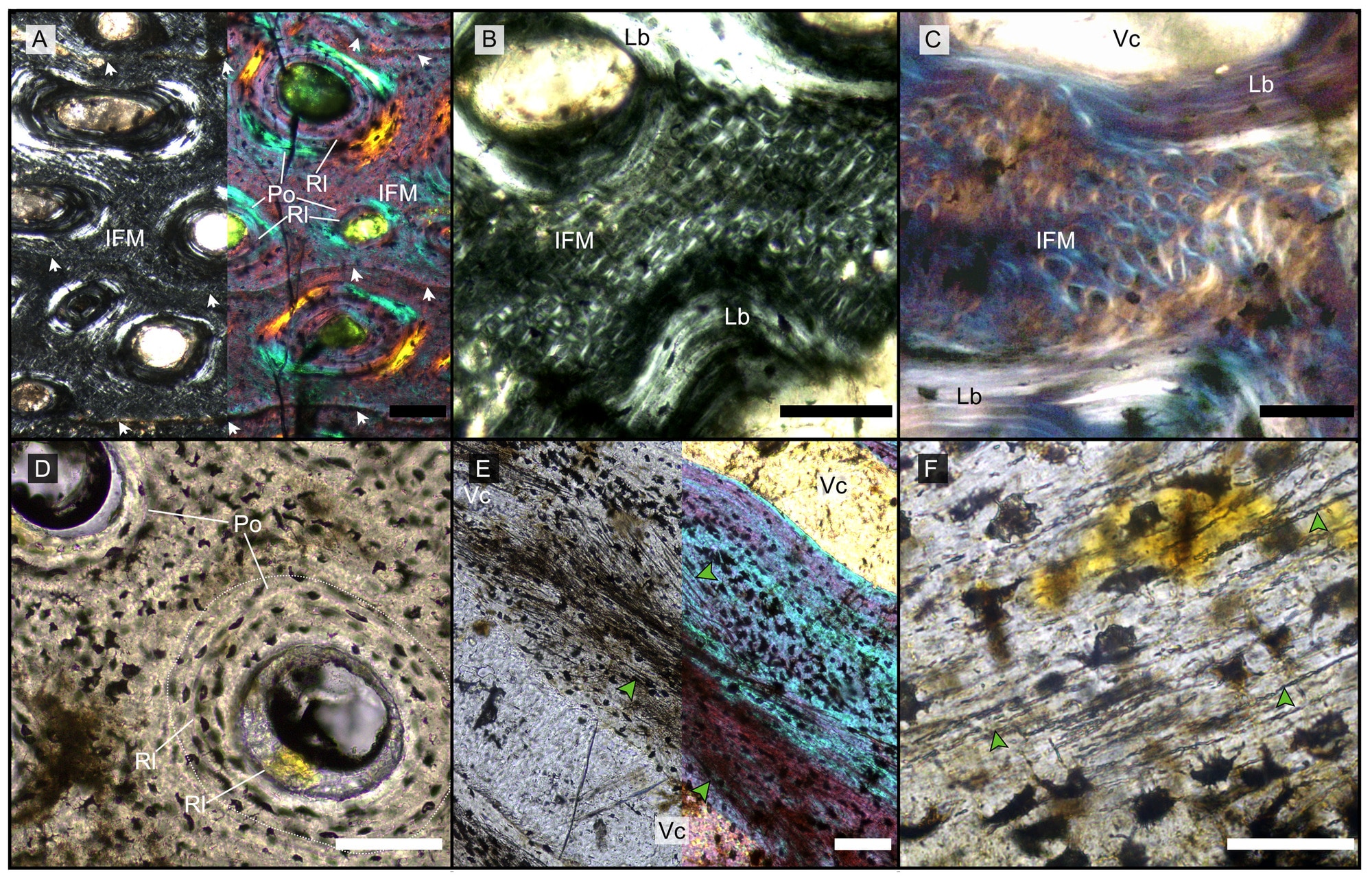 Основные гистологические особенности нижних челюстей гигантских ихтиозавров. (A) Образец демонстрирует регулярное расположение рядов первичных остеонов с вторичными остеонами внутри. (B) Сетчатый рисунок структуры внутренних волокон. (C) Кажущееся геликоидальное (спиральное) расположение периостальных структурных волокон и их взаимосвязь внутри остеональной пластинчатой кости. (D) Вид поперечного среза в нормальном свете, показывающий два первичных остеона. Правый (пунктирная линия) показывает вторичный остеон внутри первичного. (E) Продольный срез, показывающий неминерализованные волокна (темные), идущих в продольном направлении в виде елочки (зеленые стрелки) в нормальном свете (слева) и в поляризованном свете с лямбда-фильтром (справа). (F) Образец при нормальном освещении показывает неправильную форму лакун остеоцитов и неминерализованные волокна (зеленые стрелки) / © PeerJ, Marcello Perillo and P Martin Sander.