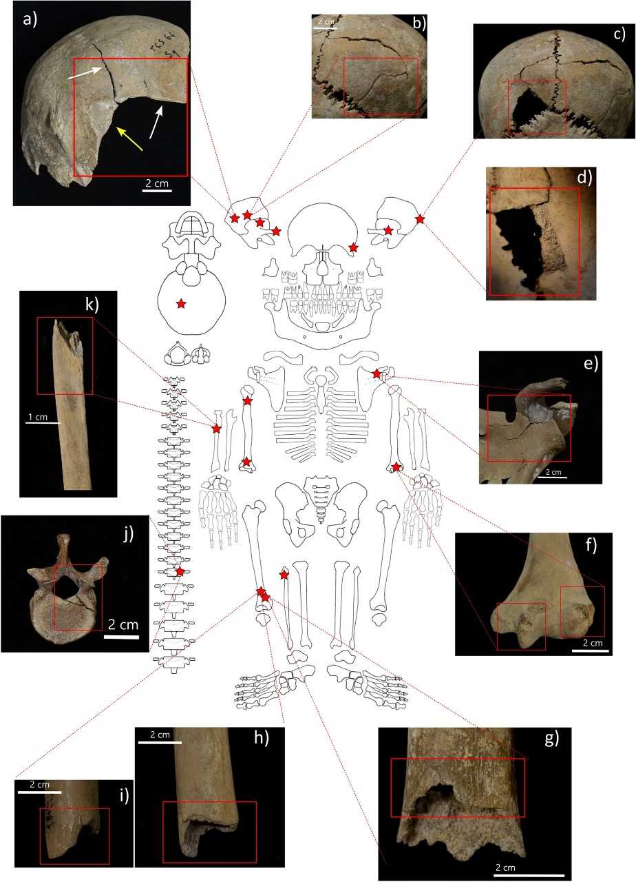 Примеры повреждений на костях / © Zita Laffranchi et al., Scientific Reports