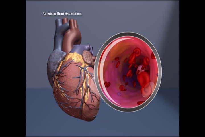 Сосуды сердца / © American Heart Association