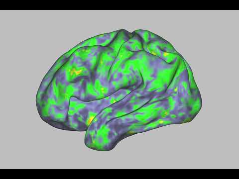 Psilocybin generates psychedelic experience by disrupting brain network