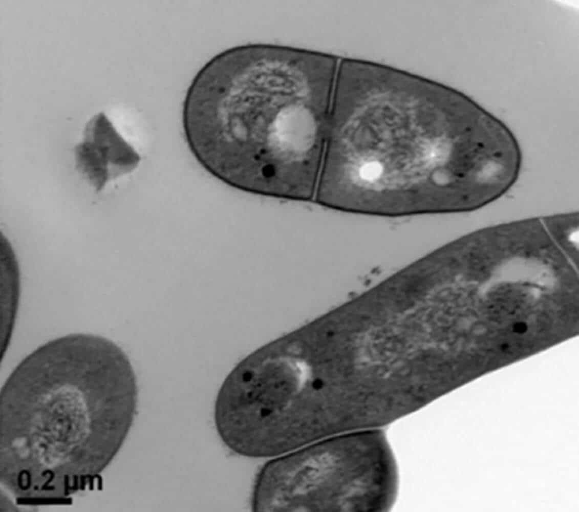 Mycobacterium spongiae под электронным микроскопом (увеличено в 33 тысячи раз) / © Plos.org, Sacha J. Pidot et al., 2024