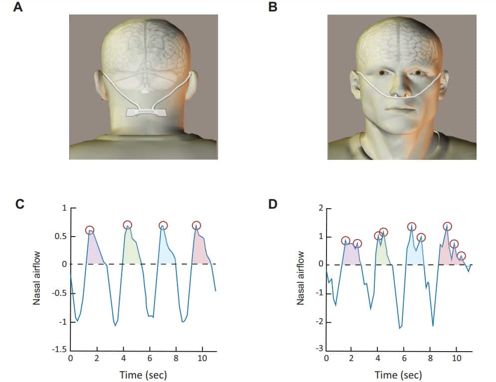 Сверху — изображение портативного датчика для измерения выдыхания через нос, снизу — графики предельного потока входа. C — у людей с аносмией, D — с нормальным обонянием, где отмечены дополнительные пики / © Lior Gorodisky et al., Nature Communications, 2024