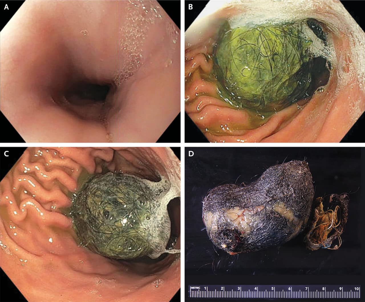 © Garrett C. Zella, Ali Pourvaziri et al., New England Journal of Medicine.