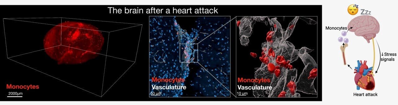 Схематическое изображение механизма исцеляющего сна после инфаркта / © Mount Sinai Health System